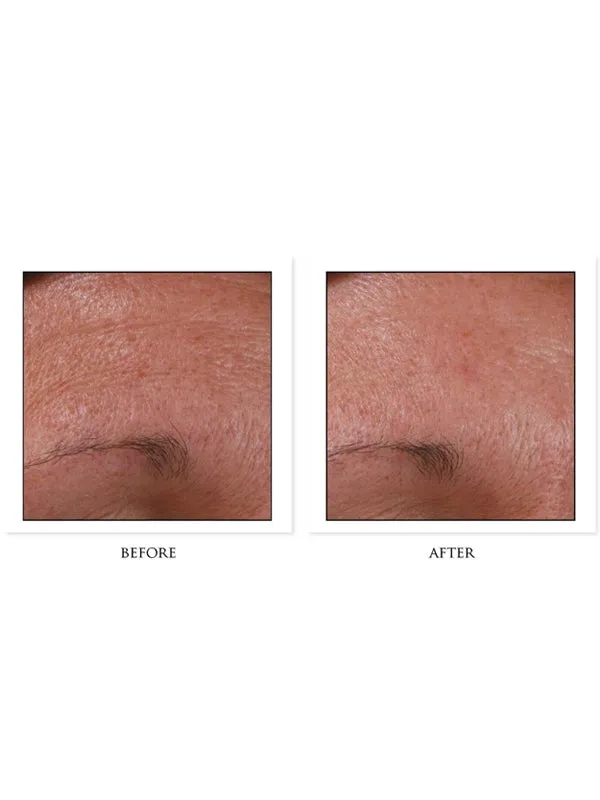CosMedix Benefit Clean