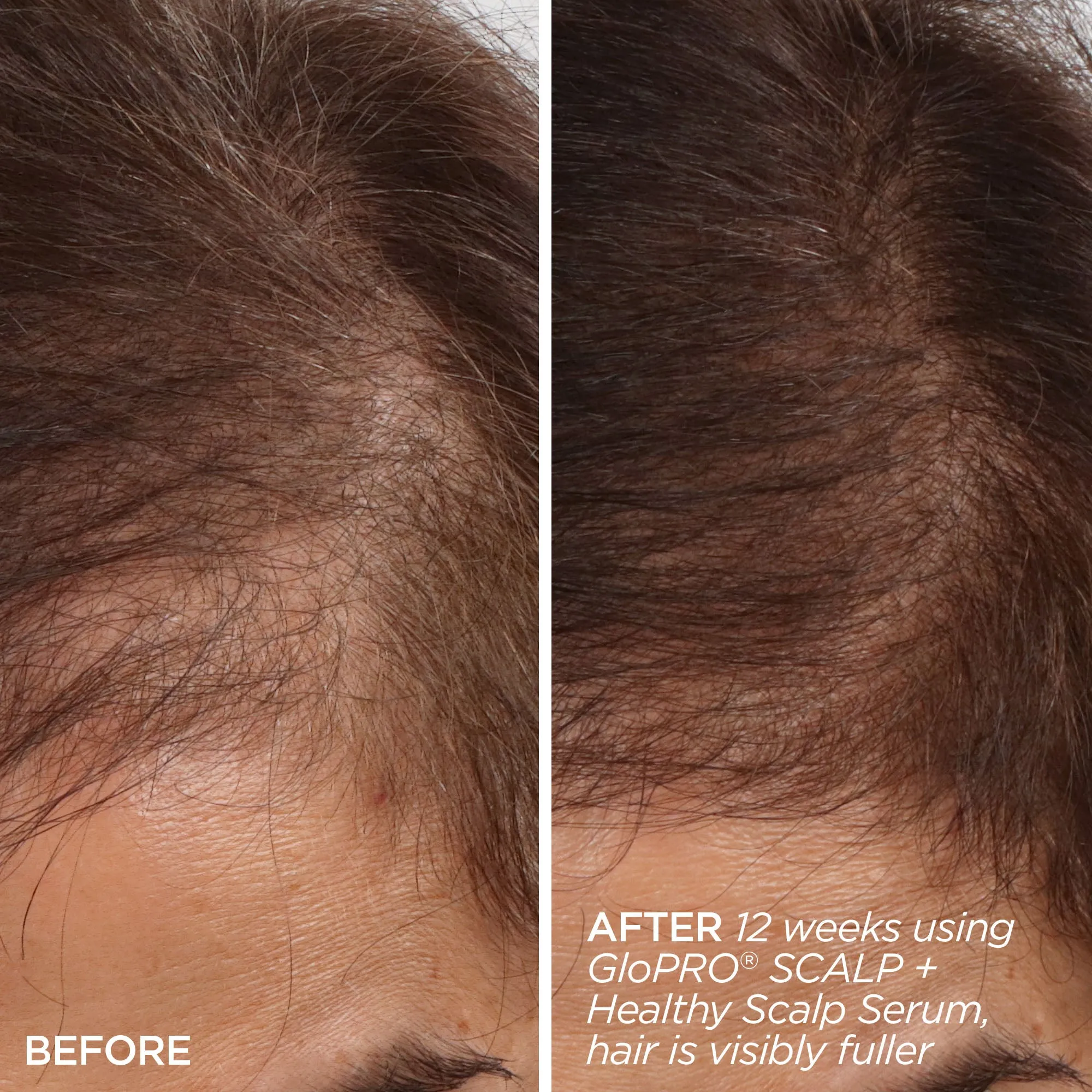 Rejuvenating Scalp   Fuller Hair Therapy Set