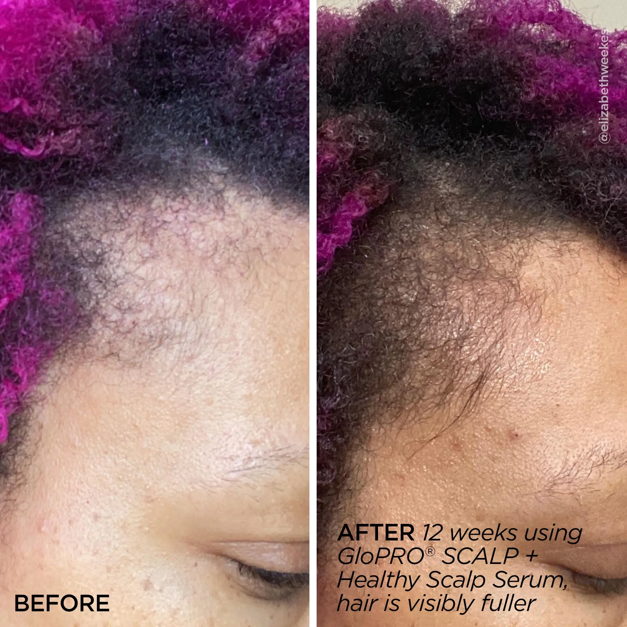 Rejuvenating Scalp   Fuller Hair Therapy Set