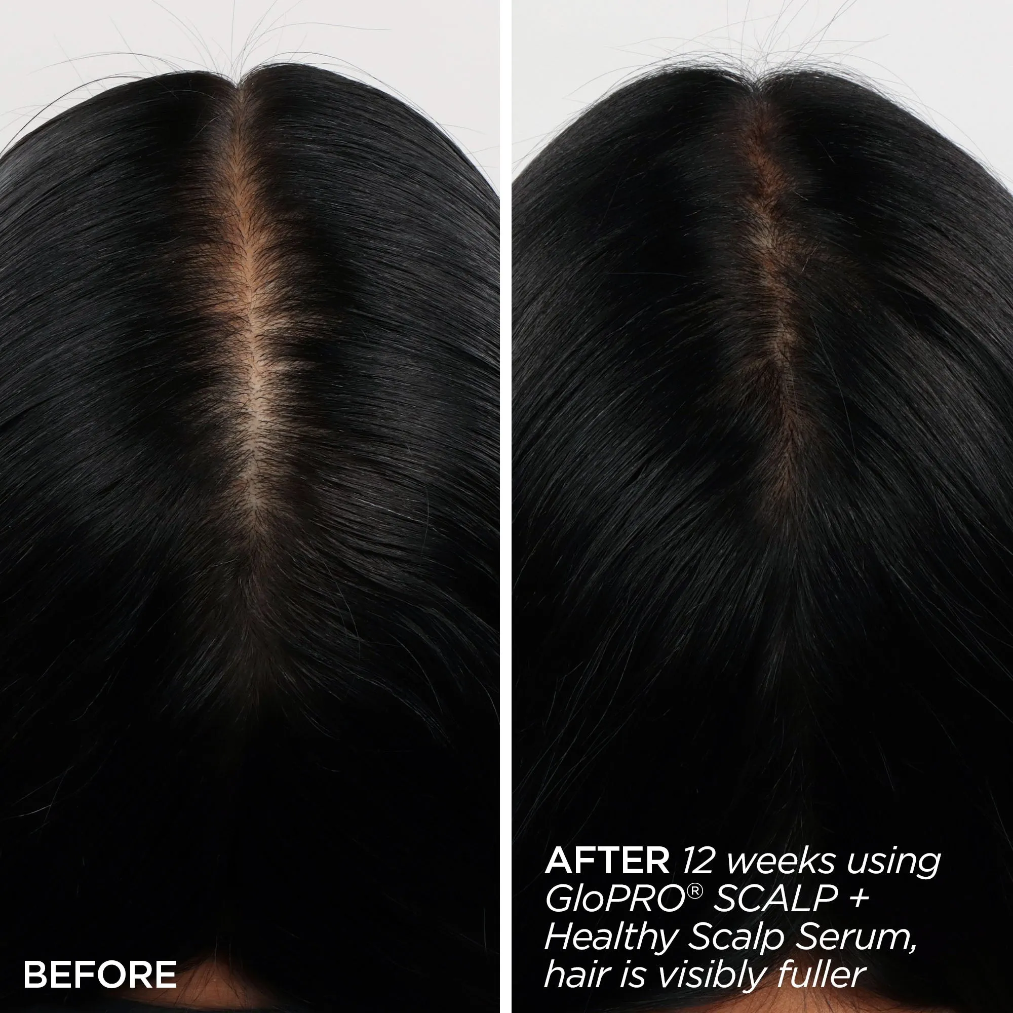 Rejuvenating Scalp   Fuller Hair Therapy Set