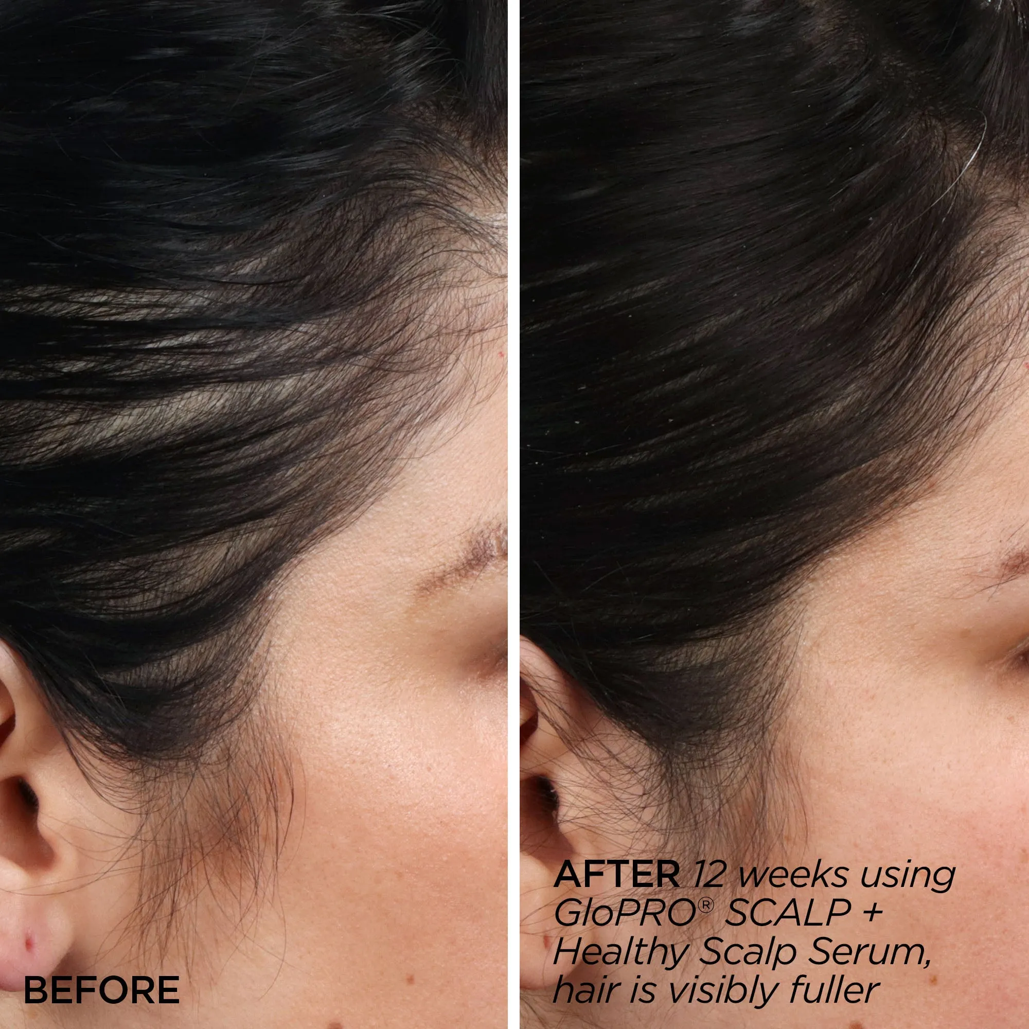 Rejuvenating Scalp   Fuller Hair Therapy Set